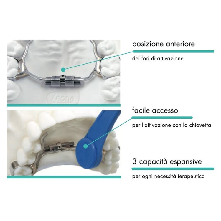 HYRAX MICRO EXPANSION EASY ACCES – AK Smile
