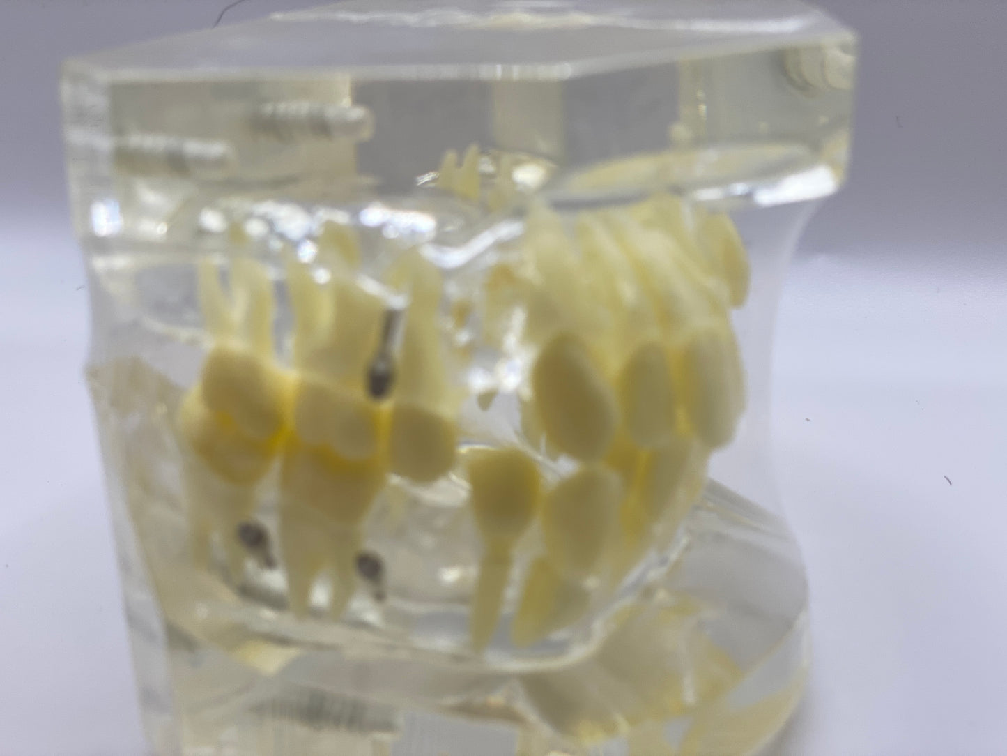 ORTHODONTIC MODEL +SCREW/ORTHODONTIC MODEL+CLEAR