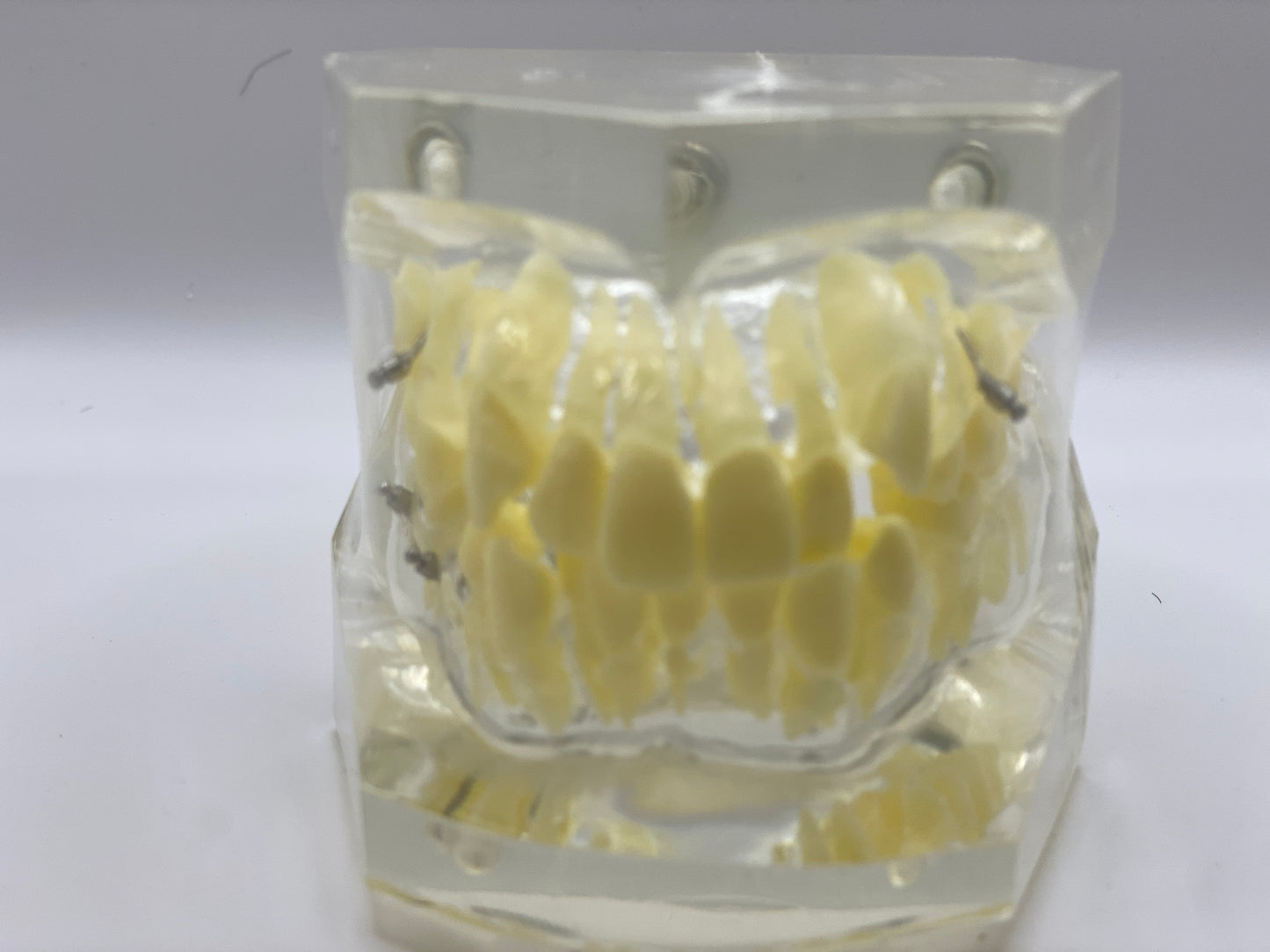 ORTHODONTIC MODEL +SCREW/ORTHODONTIC MODEL+CLEAR