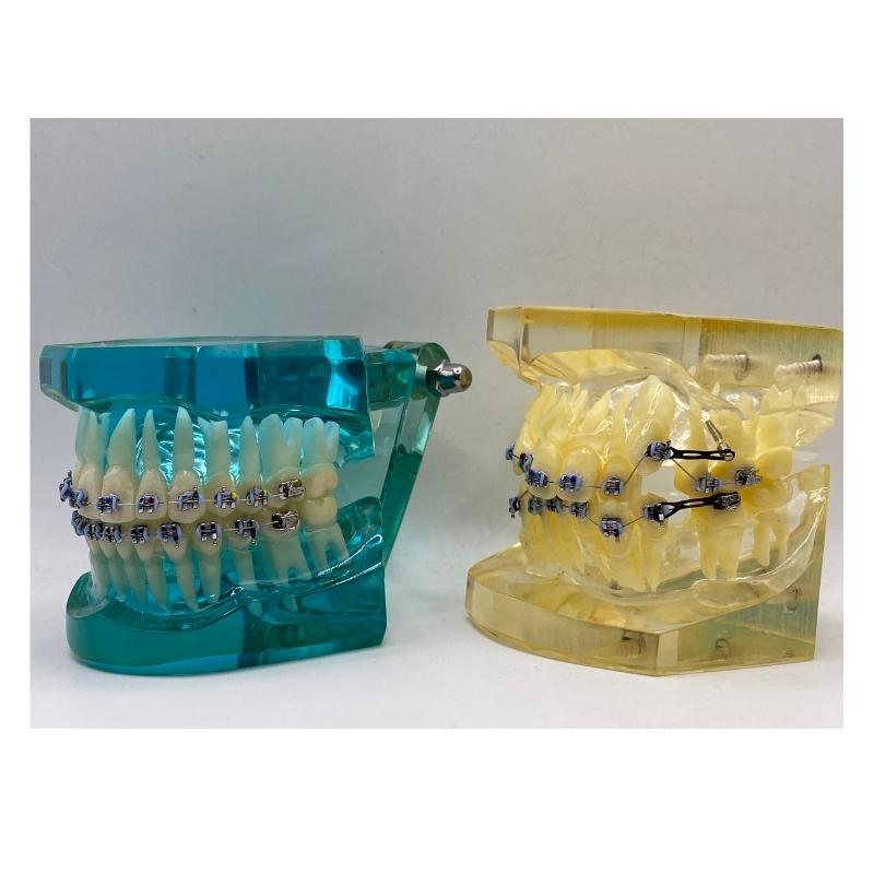 ORTHODONTIC MODEL +SCREW/ORTHODONTIC MODEL+CLEAR